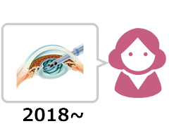 白内障手術感想