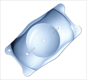 眼内コンタクトレンズ（ICL、IPCL）