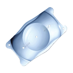 眼内コンタクトレンズ ICL・IPCL手術