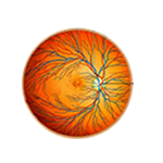 加齢黄斑変性の治療