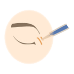 ボトックス治療