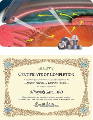 インフィニティ®ビジョンシステム